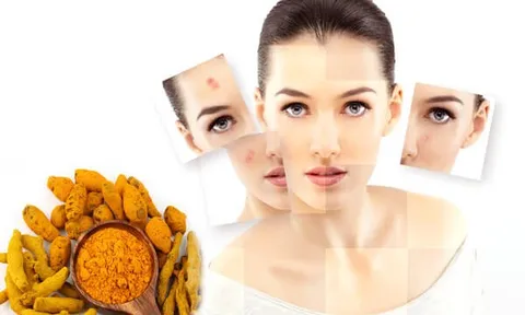 Bật mí 15 công thức làm mờ thâm mụn hiệu quả từ thiên nhiên